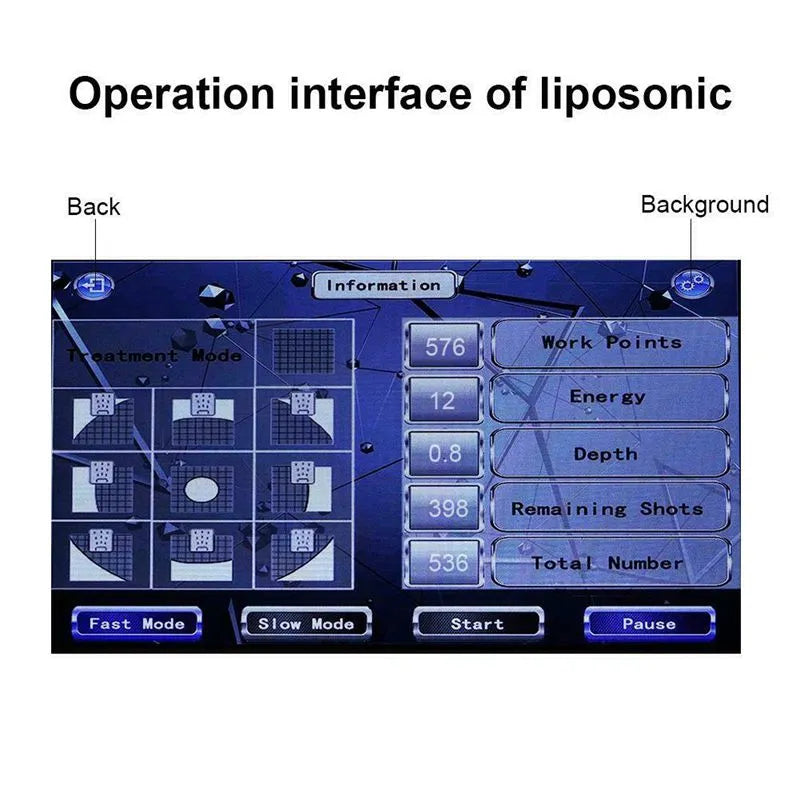 Liposonix Professional HIFU Body Slimming Machine