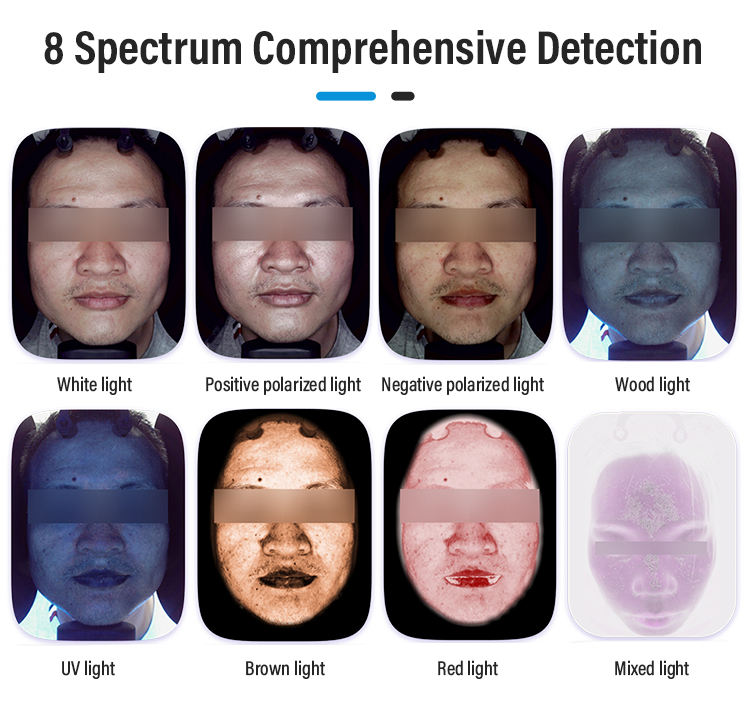 Bitmoji A6 Magic Mirror 3D Skin Analyzer with Handheld Microimager for Facial Analysis