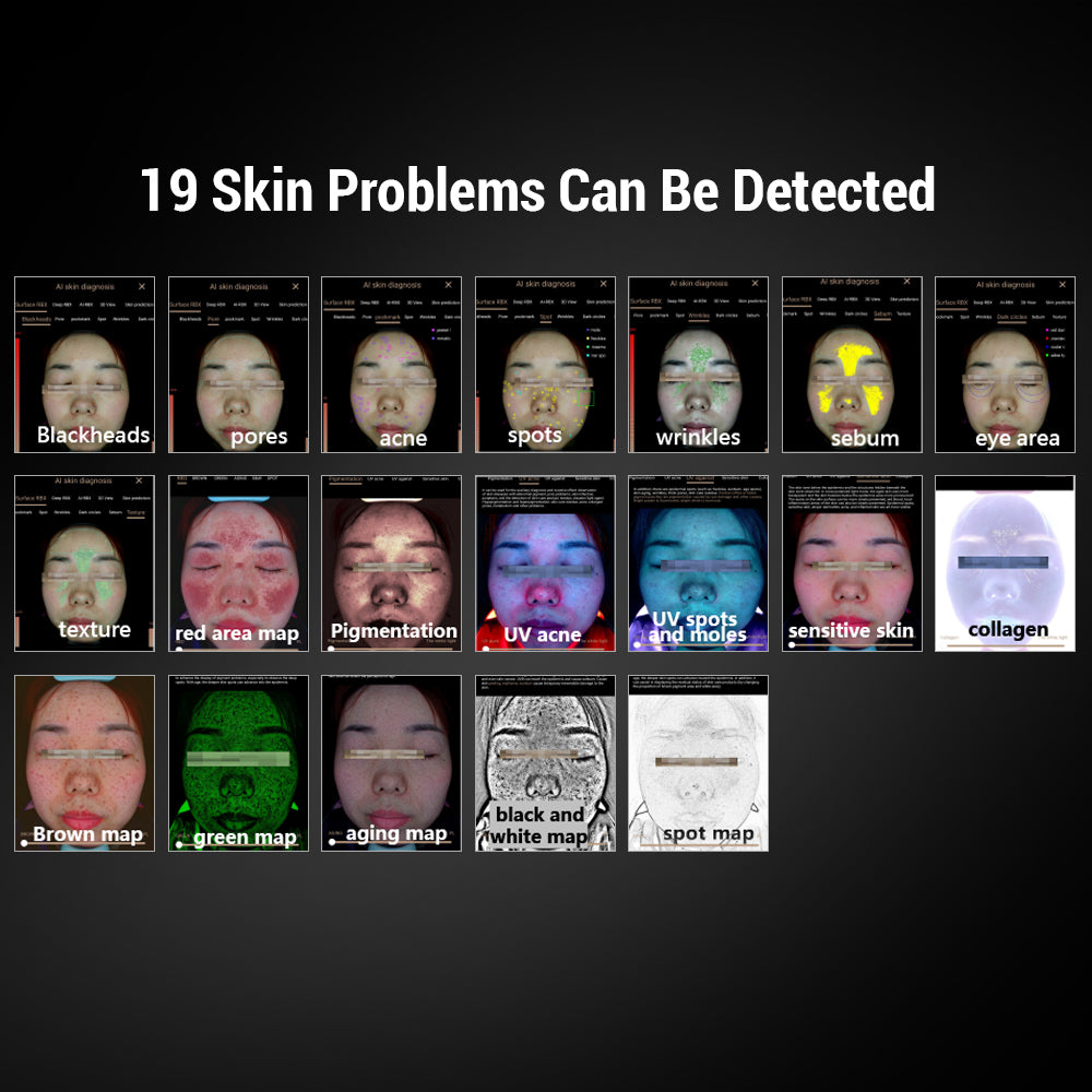 Professional 13-Spectrum AI Skin Analyser for MedSpa & Salons