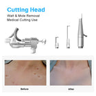 LumiLaser CO2 Fractional System — 6D Scanning 4