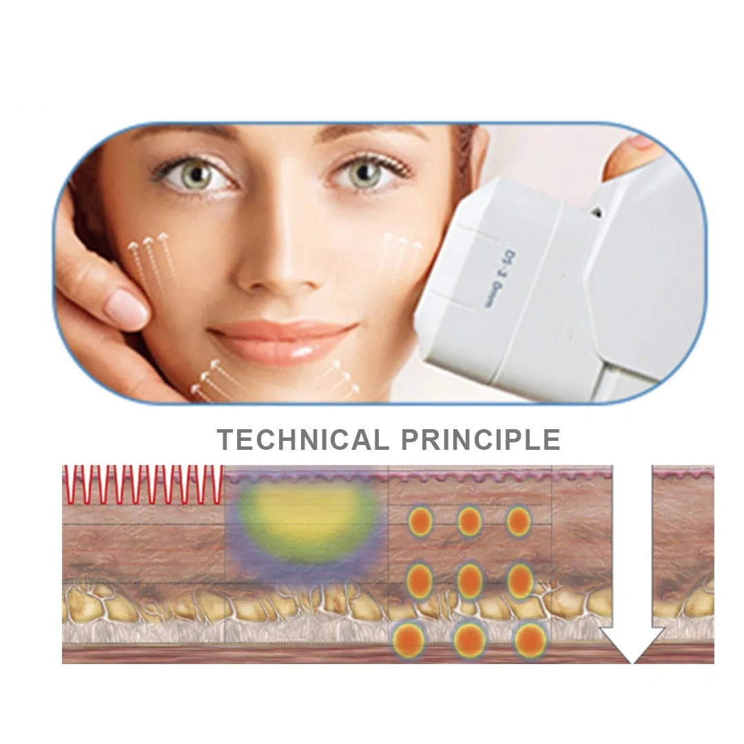 SMAS HIFU Face Lifting and Body Slimming Machine