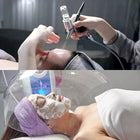 O2toDerm Oxygen Facial Dome — 92% Pure Oxygen 6