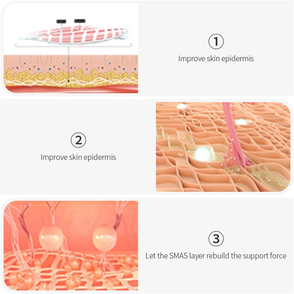 MythosSonic Professional Portable Mini HIFU Skin Tightening Machine